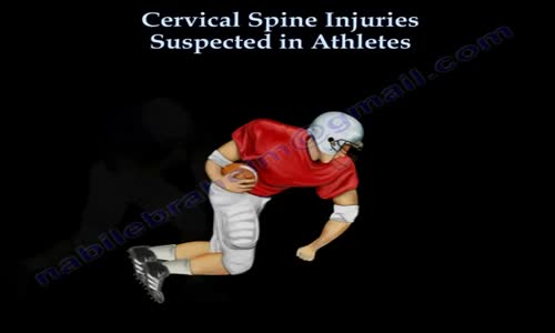 Cervical Spine Injuries Athletes Everything You Need To Know Dr. Nabil ...