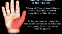 Common Conditions Of The Thumb  Everything You Need To Know  Dr. Nabil Ebraheim