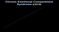 Chronic Exertional Compartment Syndrome  Everything You Need To Know  Dr. Nabil Ebraheim