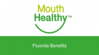 Fluoride Benefits