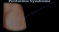 Piriformis Syndrome , sciatica  Everything You Need To Know  Dr. Nabil Ebraheim