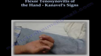 Flexor Tenosynovitis Of The Hand Kanavels Signs  Everything You Need To Know  Dr. Nabil Ebraheim