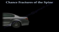 Chance Fractures of the Spine  Everything You Need To Know  Dr. Nabil Ebraheim