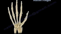 Mallet Finger  Everything You Need To Know  Dr. Nabil Ebraheim