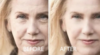 Phytoceramides Before And After
