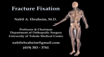 Fracture Fixation Animation  Everything You Need to Know  Dr. Nabil Ebraheim