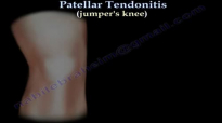 Patellar Tendonitis Jumpers Knee  Everything You Need To Know  Dr. Nabil Ebraheim