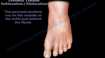Peroneal Tendon Subluxation  Dislocation  Everything You Need To Know  Dr. Nabil Ebraheim