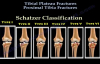 Tibial Plateau Fractures Proximal Tibia Fractures  Everything You Need To Know  Dr. Nabil Ebraheim