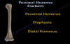 Proximal Humerus Fractures classification  Everything You Need To Know  Dr. Nabil Ebraheim