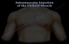 Deltoid Intramuscular injection  Everything You Need To Know  Dr. Nabil Ebraheim