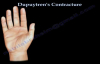 Dupuytrens Contracture  Everything You Need To Know  Dr. Nabil Ebraheim