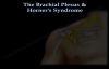 The Brachial Plexus & Horners Syndrome  Everything You Need To Know  Dr. Nabil Ebraheim