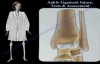Ankle Ligament Injury Tests & Assessment  Everything You Need To Know  Dr. Nabil Ebraheim