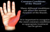 Common Conditions Of The Thumb  Everything You Need To Know  Dr. Nabil Ebraheim