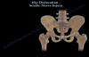 Hip Dislocation , Sciatic Nerve Injury  Everything You Need To Know  Dr. Nabil Ebraheim