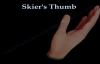 Skiers Thumb Gamekeepers Thumb  Everything You Need To Know  Dr. Nabil Ebraheim
