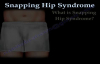 Snapping Hip Syndrome  Everything You Need To Know  Dr. Nabil Ebraheim