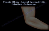 Tennis Elbow Lateral Epicondylitis Injection  Everything You Need To Know  Dr. Nabil Ebraheim