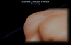 Scapula Coracoid Process Anatomy  Everything You Need To Know  Dr. Nabil Ebraheim