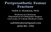 Femur Fracture, Periprosthetic fracture  Everything You Need To Know  Dr. Nabil Ebraheim