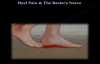 Heel Pain & The Baxters Nerve  Everything You Need To Know  Dr. Nabil Ebraheim