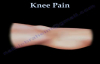 Knee Pain , common causes Everything You Need To Know  Dr. Nabil Ebraheim