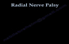 Radial Nerve Palsy, injury  WRIST DROP . Everything You Need To Know  Dr. Nabil Ebraheim