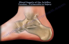 Achilles Tendon rupture , Vulnerablity to Injury  Everything You Need To Know  Dr. Nabil Ebraheim