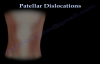 Patellar Dislocations  Everything You Need To Know  Dr. Nabil Ebraheim
