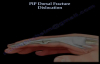 PIP Dorsal Fracture Dislocation  Everything You Need To Know  Dr. Nabil Ebraheim