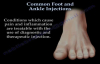 Common Foot And Ankle Injections  Everything You Need To Know  Dr. Nabil Ebraheim