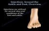Injections Around The Ankle and Foot Overview  Everything You Need To Know  Dr. Nabil Ebraheim