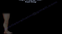 Slap gait , Steppage Gait . Foot Drop  Everything You Need To Know  Dr. Nabil Ebraheim