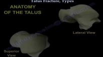 Talus Fracture Types  Everything You Need To Know  Dr. Nabil Ebraheim