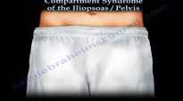 Iliopsoas, Pelvic Compartment Syndrome Everything You Need To Know Dr. Nabil Ebraheim