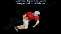 Cervical Spine Injuries Athletes  Everything You Need To Know  Dr. Nabil Ebraheim