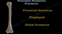 Proximal Humerus Fractures classification  Everything You Need To Know  Dr. Nabil Ebraheim