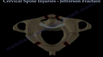 Cervical Spine Injuries Jefferson Fracture  Everything You Need To Know  Dr. Nabil Ebraheim