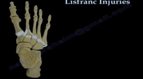 Lisfranc Injuries  Everything You Need To Know  Dr. Nabil Ebraheim