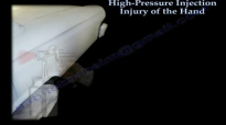 HAND HighPressure Injection Injury  Everything You Need To Know  Dr. Nabil Ebraheim