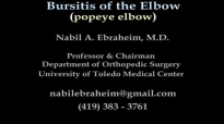 Bursitis Elbow  Olecranon Popeye Elbow  Everything You Need To Know  Dr. Nabil Ebraheim