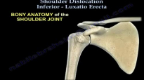 Inferio Shoulder Dislocation , Luxatio Erecta  Everything You Need To Know  Dr. Nabil Ebraheim