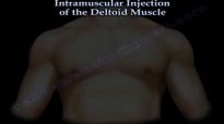 Deltoid Intramuscular injection  Everything You Need To Know  Dr. Nabil Ebraheim
