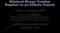 Bilateral Biceps Tendon Rupture Elderly Patient  Everything You Need To Know  Dr. Nabil Ebraheim