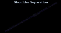 SHOULDER SEPARATION AC JOINT  Everything You Need To Know  Dr. Nabil Ebraheim