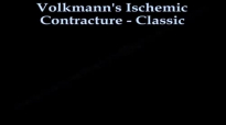 Volkmanns Ischemic Contracture Classic  Everything You Need To Know  Dr. Nabil Ebraheim