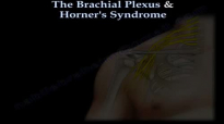 The Brachial Plexus & Horners Syndrome  Everything You Need To Know  Dr. Nabil Ebraheim