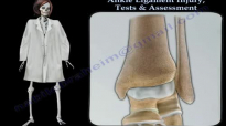 Ankle Ligament Injury Tests & Assessment  Everything You Need To Know  Dr. Nabil Ebraheim