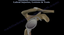 Shoulder Examinations, Labral Tear, Tests  Everything You Need To Know  Dr. Nabil Ebraheim